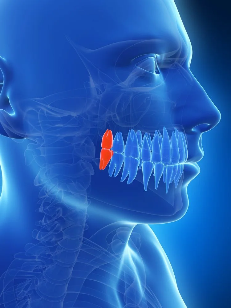 non impacted wisdom teeth